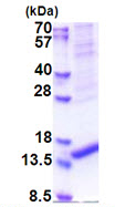 SDS-PAGE - Recombinant Human ARMS2 protein (denatured) (AB174457)