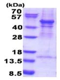 SDS-PAGE - Recombinant Human Arp3 protein (denatured) (His tag N-Terminus) (AB187418)