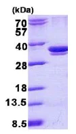 SDS-PAGE - Recombinant Human ARPC2 protein (His tag N-Terminus) (AB140555)