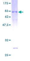 SDS-PAGE - Recombinant Human ARRDC3 protein (AB163587)