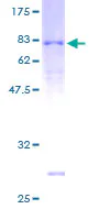 SDS-PAGE - Recombinant Human ARRDC3 protein (GST tag N-Terminus) (AB163587)