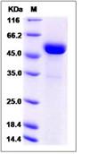 SDS-PAGE - Recombinant Human ART3 protein (His tag) (AB276555)