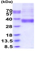 SDS-PAGE - Recombinant Human ART4/DOK1 protein (His tag) (AB229361), expandable thumbnail