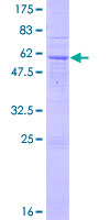 Recombinant Human ART5 protein