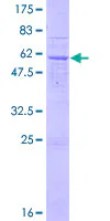 SDS-PAGE - Recombinant Human ART5 protein (GST tag N-Terminus) (AB165117)