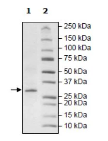 SDS-PAGE - Recombinant human ARTD10 protein (DDDDK N-Terminus + Strep C-Terminus) (AB271650)