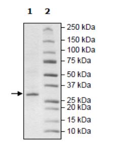Recombinant human ARTD10 protein (Tagged)