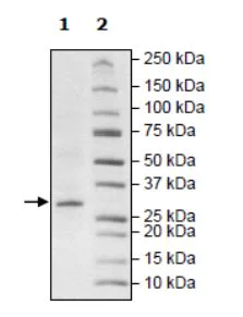 SDS-PAGE - Recombinant human ARTD10 protein (Tagged) (AB271650)
