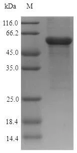 SDS-PAGE - Recombinant Human ASAH1 protein (His tag) (AB226446)