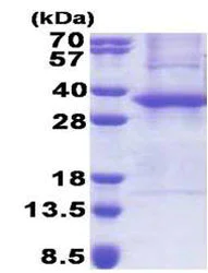SDS-PAGE - Recombinant Human ASB8 protein (His tag N-Terminus) (AB171706)