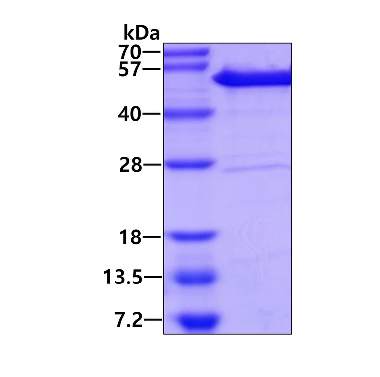 SDS-PAGE - Recombinant Human ASCC1 protein (His tag N-Terminus) (AB171688)