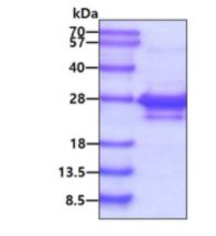 SDS-PAGE - Recombinant Human ASF1A protein (His tag N-Terminus) (AB84211)