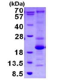 SDS-PAGE - Recombinant Human ASF1b protein (His tag C-Terminus) (AB130033)
