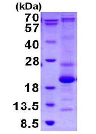 SDS-PAGE - Recombinant Human ASF1b protein (His tag C-Terminus) (AB130033)