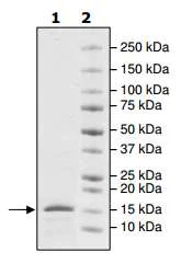 SDS-PAGE - Recombinant Human ASH1L protein (His tag N-Terminus) (AB195166)