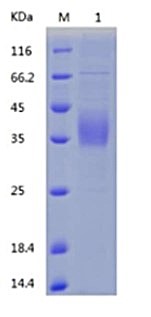 SDS-PAGE - Recombinant Human Asialoglycoprotein Receptor 1/HL-1 (AB151893)