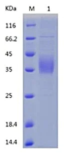 SDS-PAGE - Recombinant Human Asialoglycoprotein Receptor 1/HL-1 (AB151893)