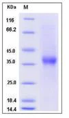 SDS-PAGE - Recombinant Human Asialoglycoprotein Receptor 1/HL-1 (His tag) (AB276316)