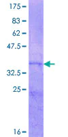 SDS-PAGE - Recombinant Human ASIP protein (AB157919)