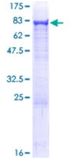 SDS-PAGE - Recombinant Human Asparagine synthetase protein (AB152201)
