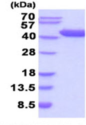 Recombinant human Aspartate Aminotransferase protein (His tag)