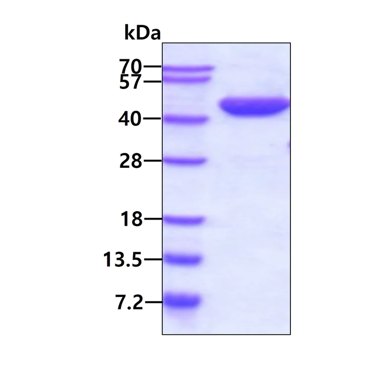 SDS-PAGE - Recombinant Human Aspartate Aminotransferase protein (His tag N-Terminus) (AB99147)