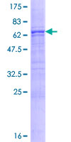 SDS-PAGE - Recombinant Human Asporin protein (AB132382), expandable thumbnail