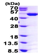 SDS-PAGE - Recombinant Human ASS1 protein (His tag N-Terminus) (AB98084)