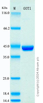 SDS-PAGE - Recombinant Human AST Protein Standard (His tag) (AB316584)
