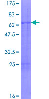 Recombinant Human ATF5 protein