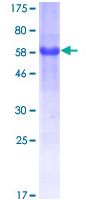 Recombinant Human ATF6 protein