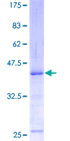 SDS-PAGE - Recombinant Human ATM protein (GST tag N-Terminus) (AB131739)