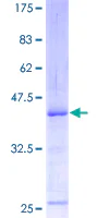 SDS-PAGE - Recombinant Human ATM protein (GST tag N-Terminus) (AB131739)