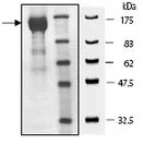 SDS-PAGE - Recombinant human ATP citrate lyase protein (GST tag N-Terminus) (AB196090)