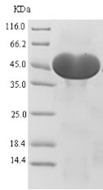 SDS-PAGE - Recombinant Human ATP citrate lyase protein (His tag) (AB235007)