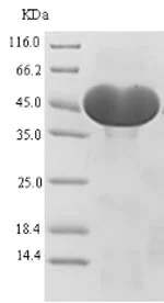 SDS-PAGE - Recombinant Human ATP citrate lyase protein (His tag) (AB235007)
