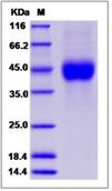 SDS-PAGE - Recombinant Human ATP1B1 protein (His tag) (AB276617), expandable thumbnail