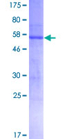 SDS-PAGE - Recombinant Human ATP1B3 protein (GST tag N-Terminus) (AB157927)
