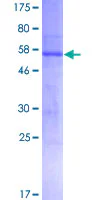 SDS-PAGE - Recombinant Human ATP1B3 protein (GST tag N-Terminus) (AB157927)