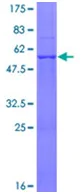 SDS-PAGE - Recombinant Human ATP5F1 protein (AB152211)