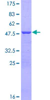 SDS-PAGE - Recombinant Human ATP5H protein (AB153084)