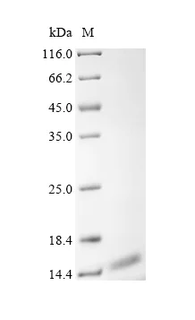 SDS-PAGE - Recombinant Human ATP5J2 Protein (His Tag) (AB314613)