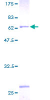 Recombinant Human ATP6V0D1/P39 protein