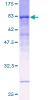 SDS-PAGE - Recombinant Human ATP6V1B1 protein (AB157939)