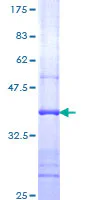 SDS-PAGE - Recombinant Human ATP6V1C1 protein (GST tag N-Terminus) (AB116917)