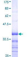 SDS-PAGE - Recombinant Human ATP7A protein (AB114343), expandable thumbnail