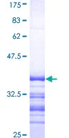 SDS-PAGE - Recombinant Human ATP7b protein (AB152216)