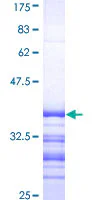 SDS-PAGE - Recombinant Human ATP7b protein (GST tag N-Terminus) (AB152216)