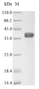 SDS-PAGE - Recombinant Human ATRAP protein (AB289750)