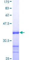 SDS-PAGE - Recombinant Human ATRX protein (AB152218)
